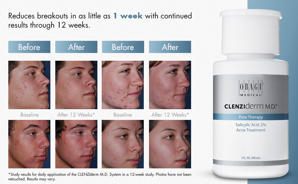 CLENZIderm M.D.® Pore Therapy Refreshing Pore-Refining Toner